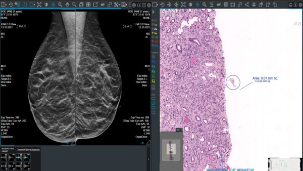 Compare_Viewer1