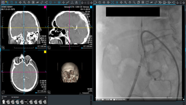 Compare_Viewer2