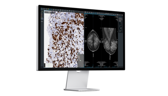 confronto digital pathology - mammografia