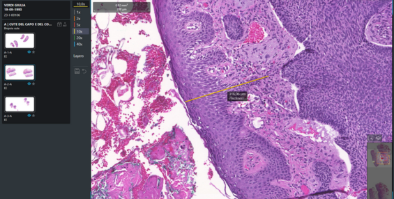 Digtal Pathology Viewer ZEEROmed